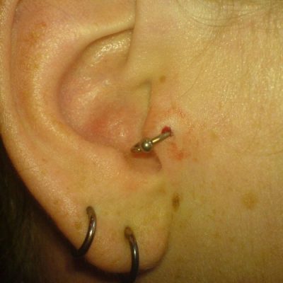 Lobe ear piercing
